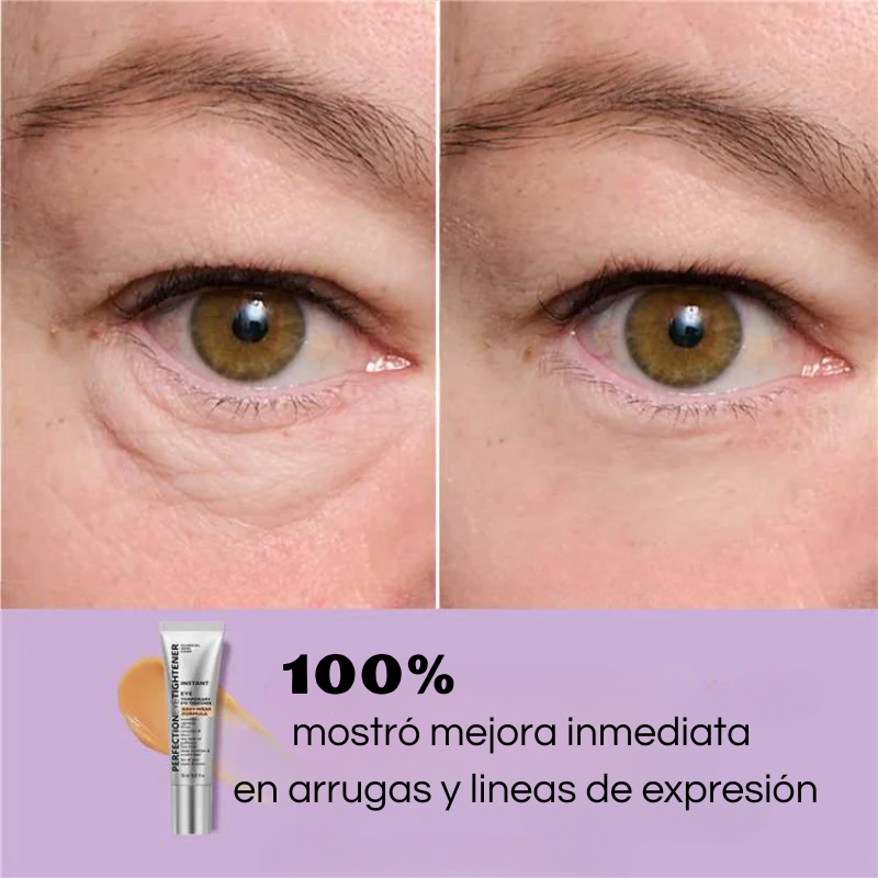 Instant Lift Ojeras & Arrugas